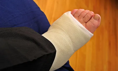 Understanding the use of thromboprophylaxis for patients with lower limb immobilisation