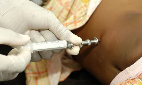 The nurse’s role in assisting with a lumbar puncture in an infant or child