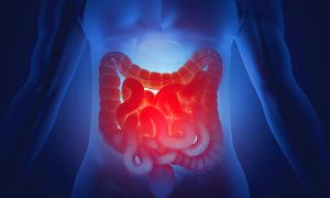 Inflammatory bowel disease: investigations used in its diagnosis and monitoring