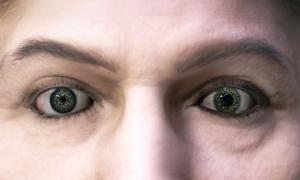 Acute anisocoria: learning from a case of accidental exposure to nebulised medicines in the emergency department