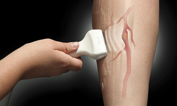 Non-medical prescribing: a reflective case study on prescribing anticoagulation for deep vein thrombosis