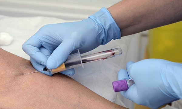 Use of glycated haemoglobin blood test (HbA1c) screening for health promotion in surgical gynaecology oncology patients