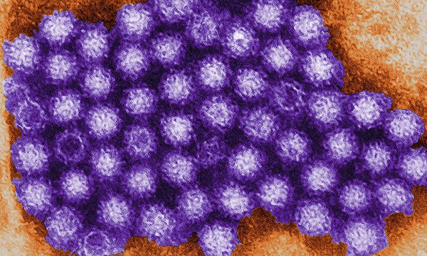 illustration of norovirus