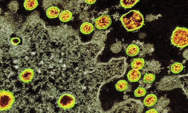Covid-19 (coronavirus)