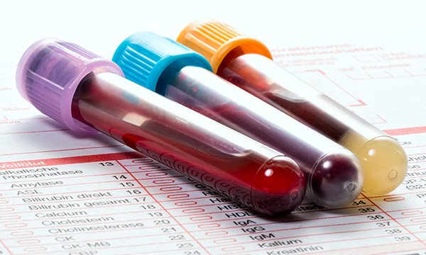 Rhabdomyolysis: a case-based critical reflection on its causes and diagnosis