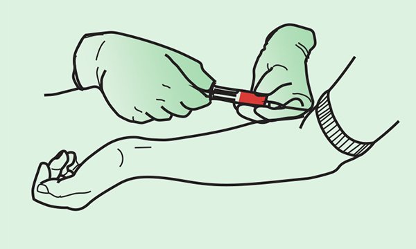 Image of a blood sample being taken from an arm