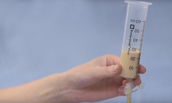 Implementing blended feeding for children with intellectual disabilities in a school environment