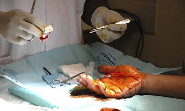 Hand injury: investigating the accuracy of referrals to a specialist trauma centre