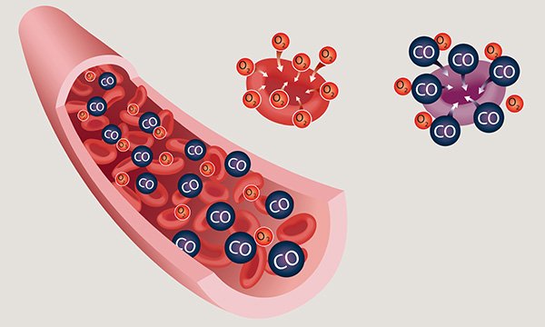 Carbon monoxide exposure