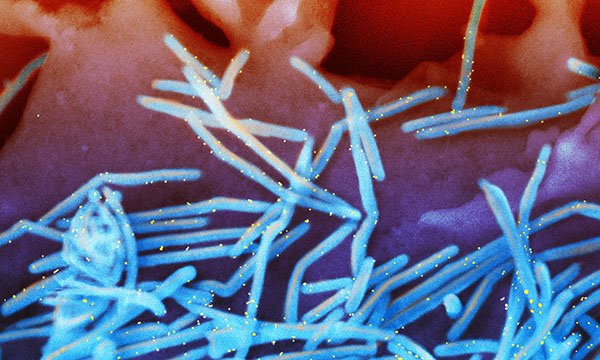 RSV particles in human lung cells