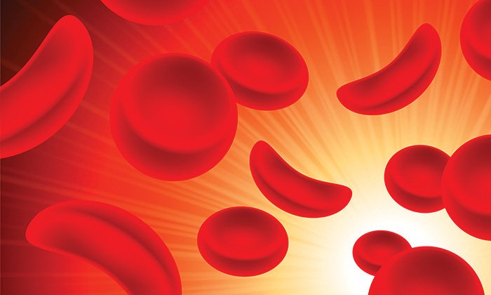 Assessing and managing people with sickle cell disease presenting with vaso-occlusive crisis in the emergency department