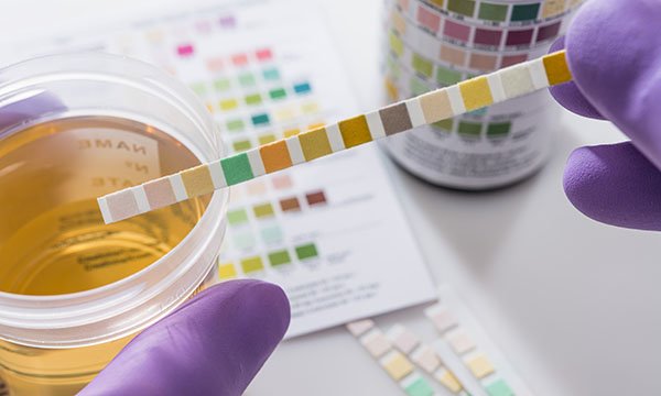 Clinical assessment of lower urinary tract symptoms in adults