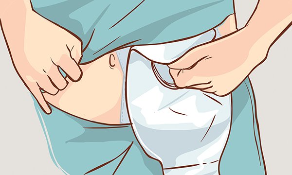 Dietary management of patients with a high-output stoma