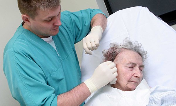 Comparing the hair apposition technique with traditional closure in scalp lacerations: a literature review