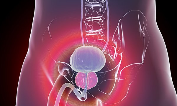 Assessment and management of lower urinary tract symptoms in men