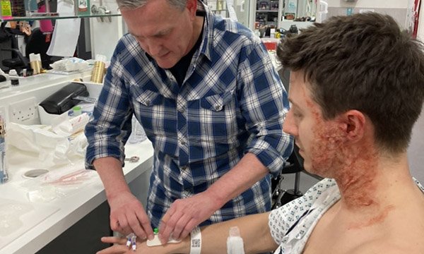Photo of burns nurse Paul Blakemore preparing actor Ryan Prescott before filming a scene