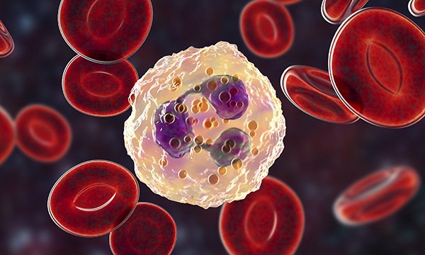 Neutropenic sepsis: evaluating the timeliness of initial patient management on presentation to hospital
