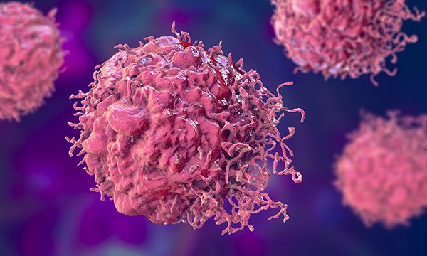 Scientific 3D illustration of cancer cells: Neuroendocrine Cancer UK has published an ideal patient care pathway for nurses and other healthcare professionals for people with neuroendocrine neoplasms