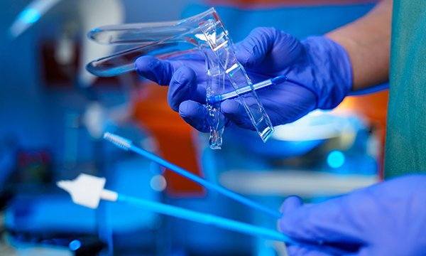 Access to cervical screening for women  with lower limb mobility impairments: an integrative literature review