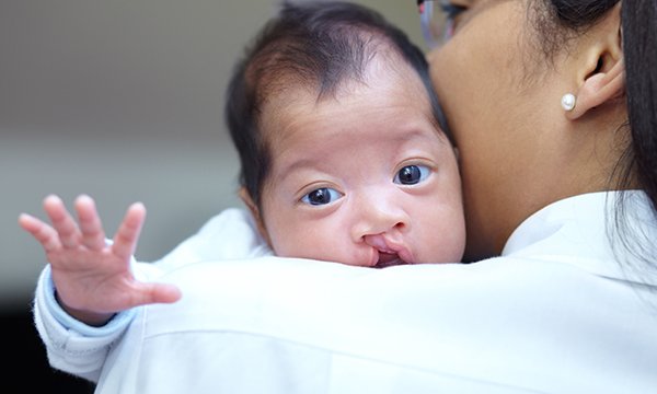 Care of an infant born with a cleft palate: a case study