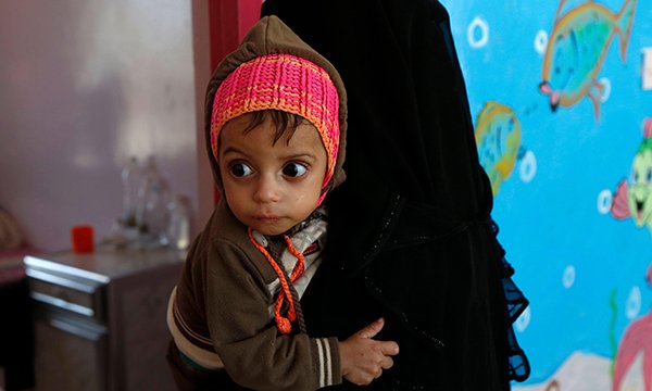 Exploring risk factors for undernutrition in children aged under five years in Yemen