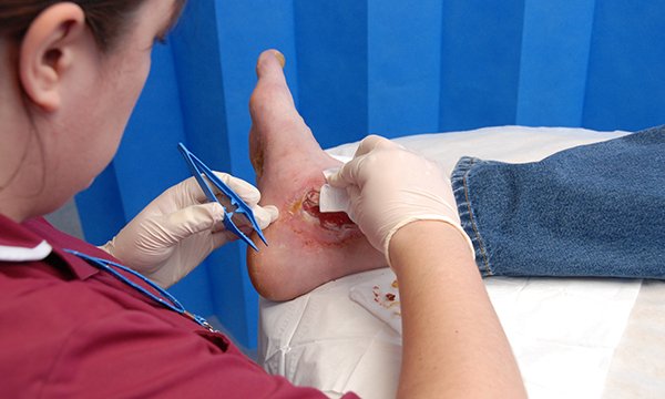Understanding the physiology of wound healing and holistic wound assessment