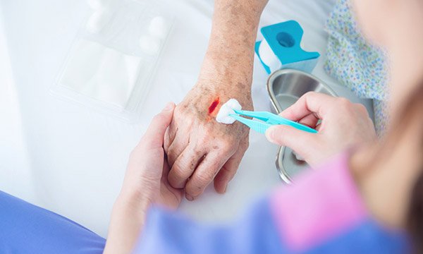 Wound infection: diagnosis, treatment and prevention