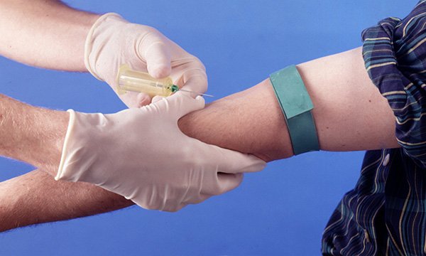 Multiple needle insertion attempts: insights from a US survey of patients and nurses