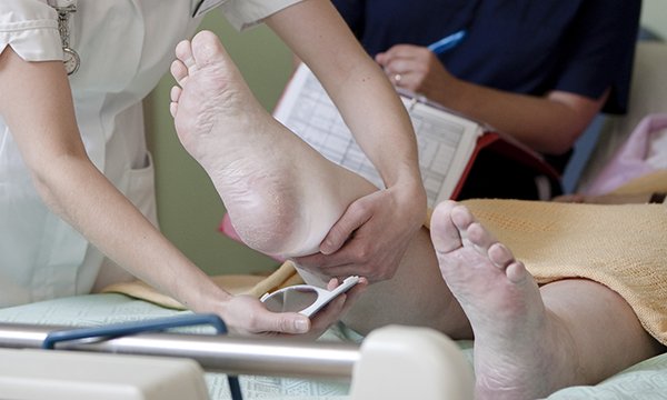 Pressure ulcer screening: nurses check the status of skin on the patient’s heel using a mirror