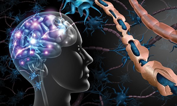 An overview of multiple sclerosis: diagnosis, causes and symptom management