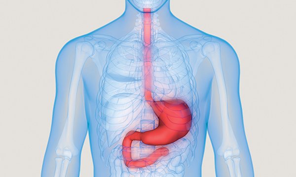 Upper gastrointestinal (GI) bleed: illustration of human anatomy showing the route a GI bleed takes 