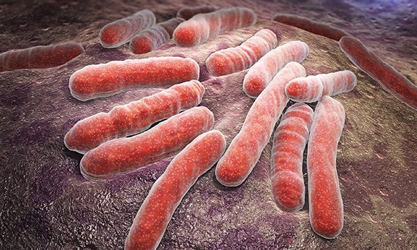 Bacterial TB infection