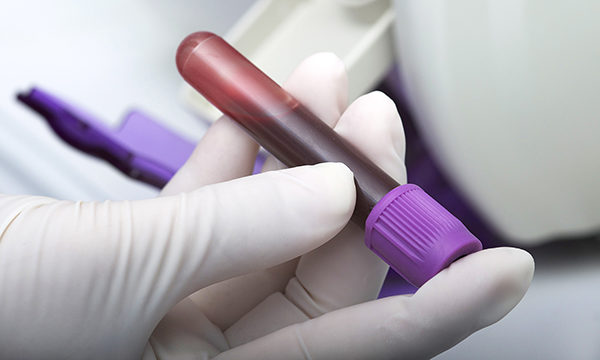 Blood_sample-iStock.jpg