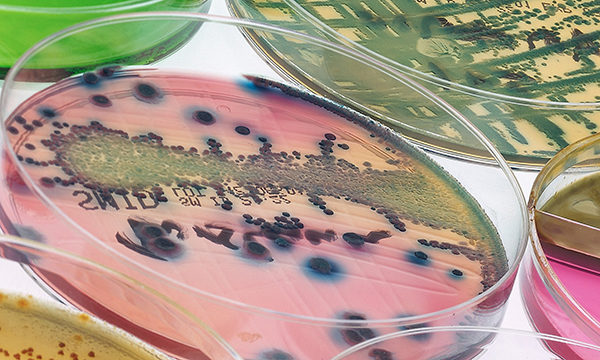 bacteria in Petri dish