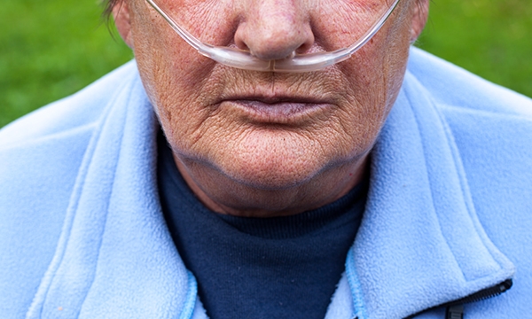 chronic obstructive pulmonary disease