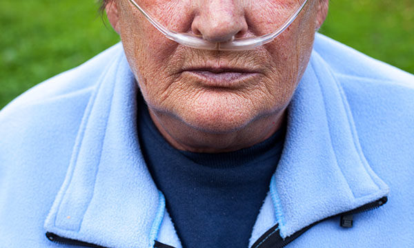 Chronic obstructive pulmonary disease