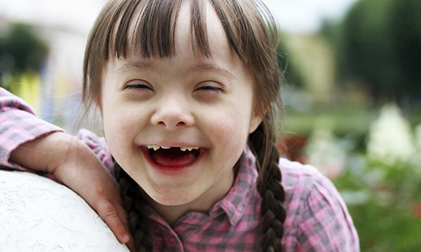 Down's syndrome child
