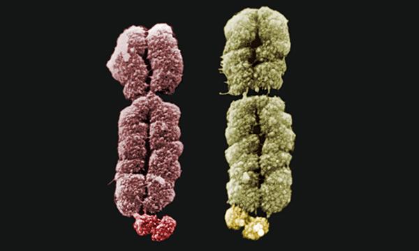 Fragile X chromosomes