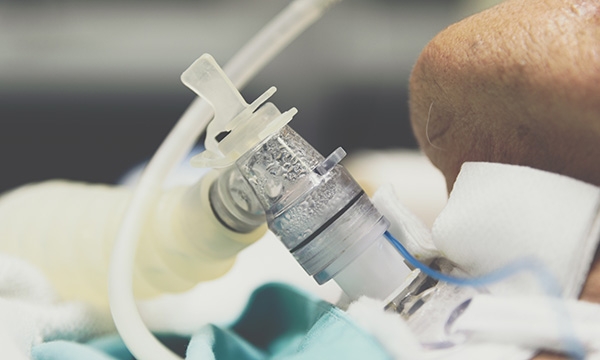 Mechanical ventilation