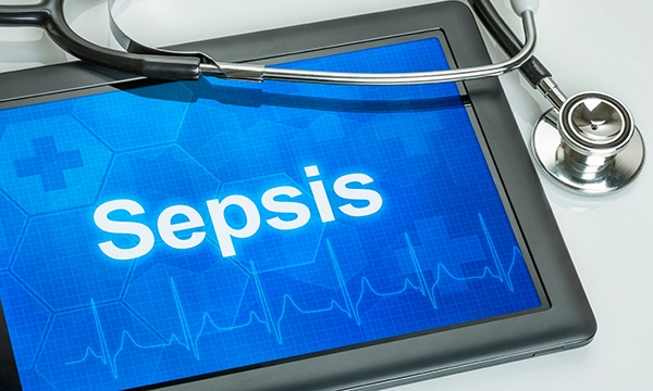 Sepsis