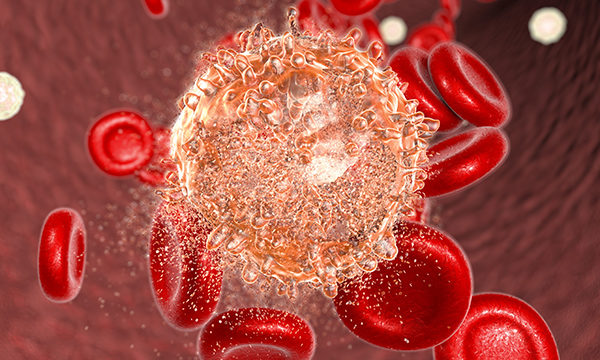 Meeting the psychosocial needs of adolescents and their families during a diagnosis of acute lymphoblastic leukaemia 