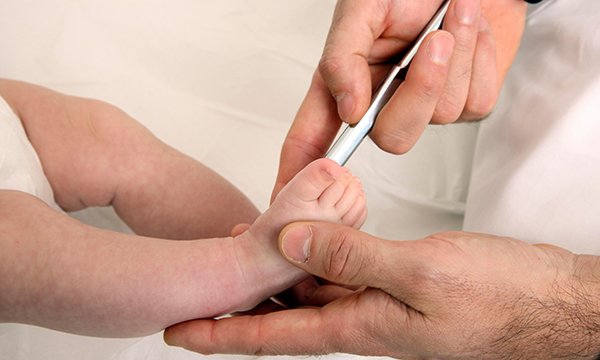 Biological basis of child health 4: an overview of the central nervous system and principles of neurological assessment