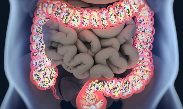 Improving outcomes for patients with irritable bowel syndrome in primary care, with specific focus on diet