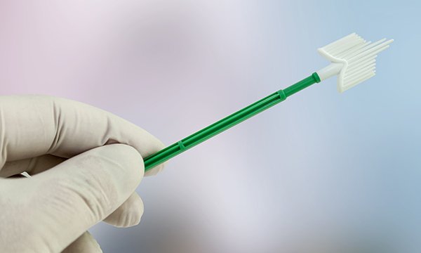 Improving women’s uptake of cervical screening in primary care